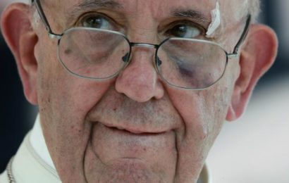 Video: How Pope Francis Shed Blood on Sunday Procession