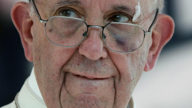 Video: How Pope Francis Shed Blood on Sunday Procession