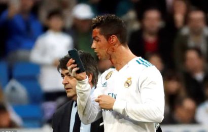 Video: Cristiano Ronaldo Checks Bloody Head Injury on Phone