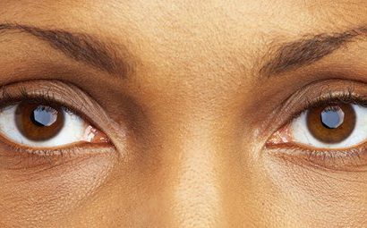 Women warned on dangers of fixing artificial eyelashes